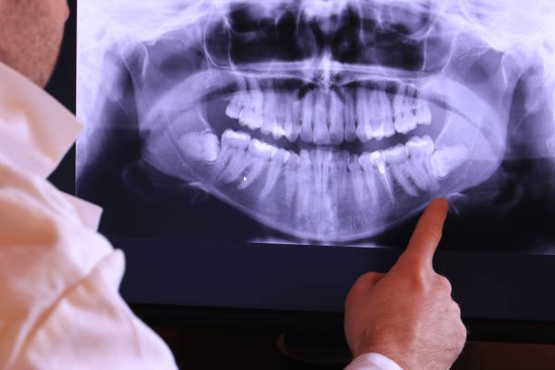 Best Urgent Tooth Repair  in Bystrom, CA