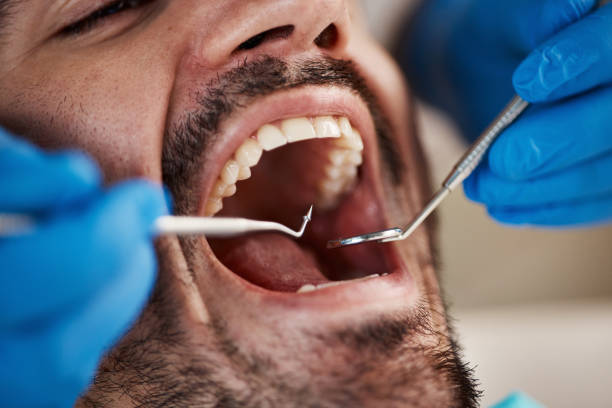 Best Emergency Gum Pain Relief  in Bystrom, CA