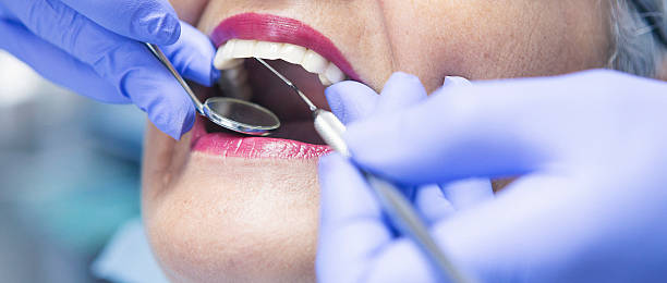 Best Root Canal Emergency Dentist  in Bystrom, CA